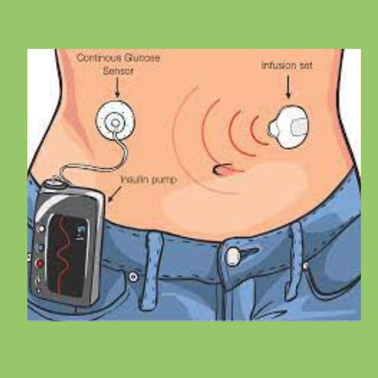 Looping and Artificial Pancreas - The Diabetes Kitchen